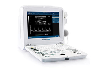 Usg - ultrasonograf